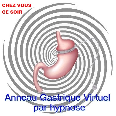 Anneau gastrique virtuel, hypnose