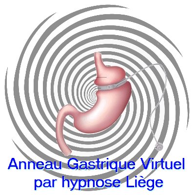 Anneau gastrique virtuel, hypnose